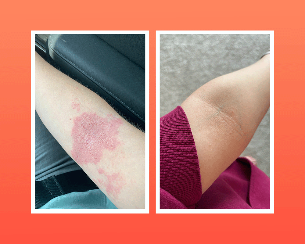 Blog Picture before and after 1